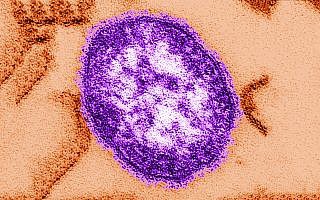 נגיף החצבת תחת המיקרוסקופ (צילום: AP Photo/Centers for Disease Control and Prevention, Cynthia Goldsmith)