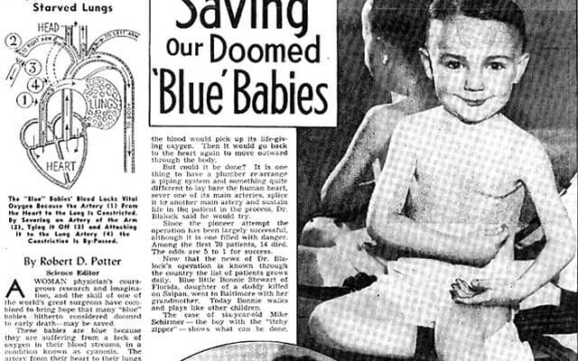 ידיעה על התינוקות הכחולים