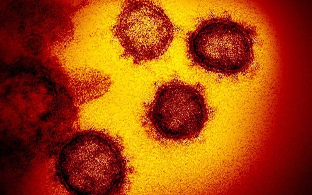 התמונה הזאת, שהתקבלה באמצעות מיקרוסקופ אלקטרונים חודר, מראה את הסארס וירוס קורונה 2, הנגיף שגורם לקוביד-19, לאחר שבודד מחולה בארצות הברית, מופיע על פני השטח של תאים שתורבתו במעבדה (צילום: NIAID-RML/ויקיפדיה)