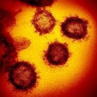 התמונה הזאת, שהתקבלה באמצעות מיקרוסקופ אלקטרונים חודר, מראה את הסארס וירוס קורונה 2, הנגיף שגורם לקוביד-19, לאחר שבודד מחולה בארצות הברית, מופיע על פני השטח של תאים שתורבתו במעבדה (צילום: NIAID-RML/ויקיפדיה)