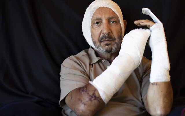 ריינייה ג&#039;רייסטי, 63, איש עסקים, שנפצע בביתו במהלך הפיצוץ בנמל ביירות, אוגוסט 2020 (צילום: AP Photo/Hassan Ammar)
