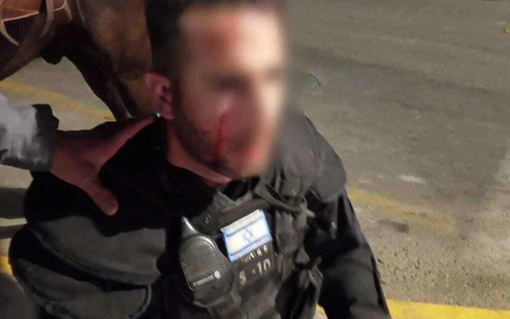 שוטר מיחידת פרשים נפצע בהפרות סדר יד שער שכם בירושלים, 22 בפאריל 2021 (צילום: דוברות המשטרה) שוטר מיחידת פרשים נפצע בהפרות סדר יד שער שכם בירושלים, 22 בפאריל 2021 (צילום: דוברות המשטרה)