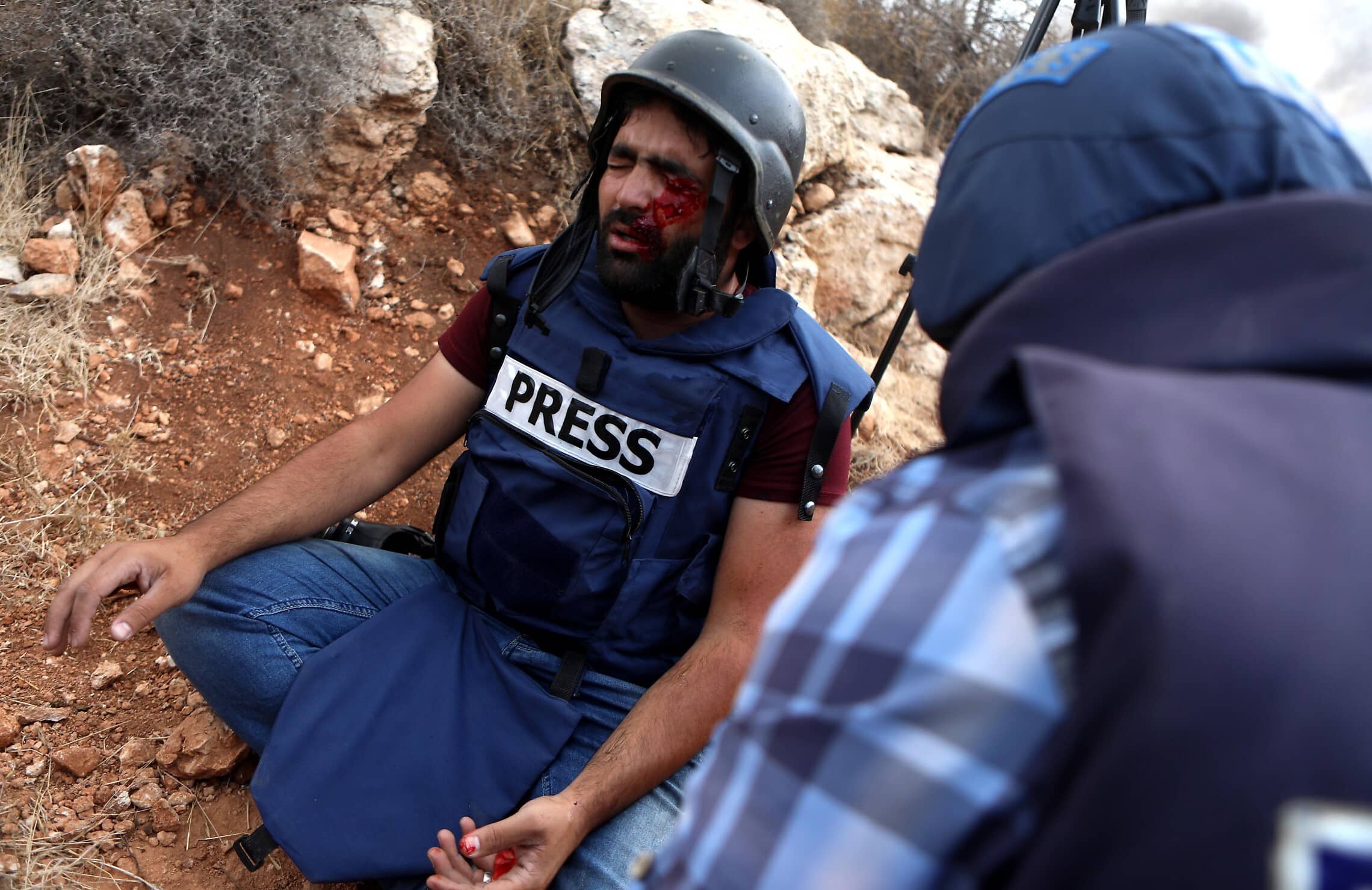 צלם פלסטיני, מואט אמרנה, אחרי שנפגע מכדור גומי שנורה על ידי חייל צה&quot;ל ליד חברון, 15 בנובמבר 2019 (צילום: פלאש90)