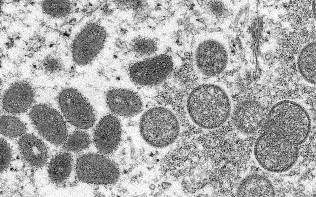 וירוס אבעבועות הקוף תחת מיקרוסקופ (צילום: Cynthia S. Goldsmith, Russell Regner/CDC via AP)