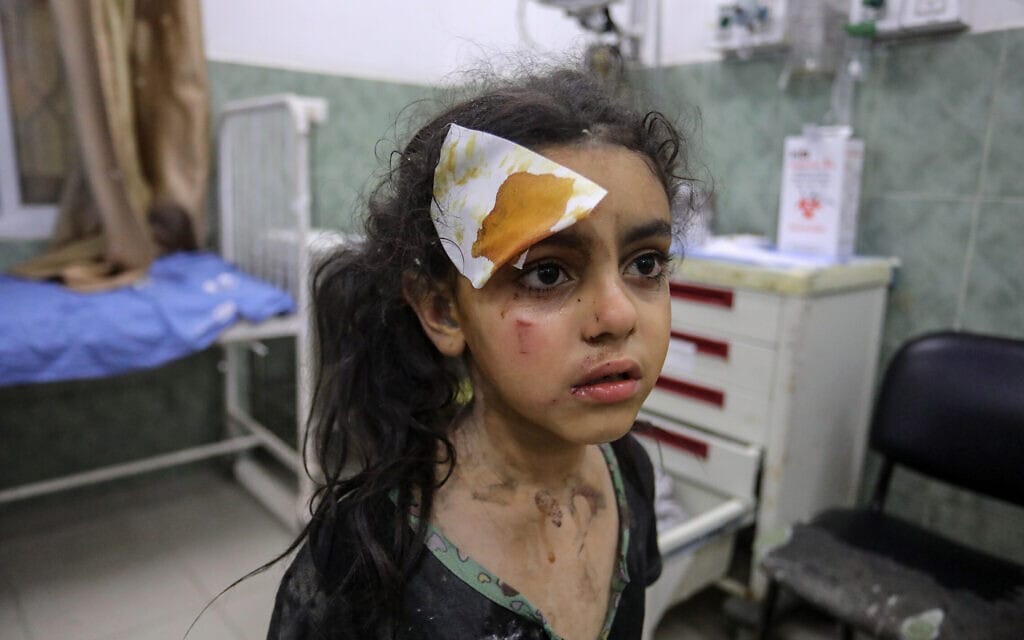 ילדה פלסטינית מקבלת טיפול בעזה על רקע התקיפות הישראליות ברצועה במסגרת מבצע "עלות השחר", 6 באוגוסט 2022 (צילום: Abed Rahim Khatib/Flash90)