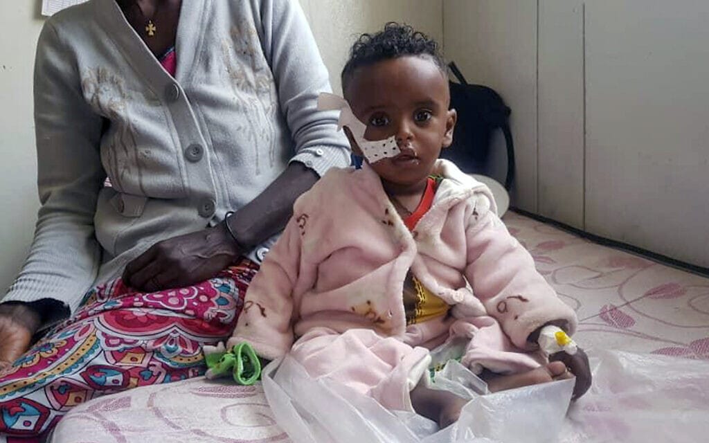 יונאס מברהיטו, ילד הסובל מרעב, ואימו, בבית חולים בתיגראי שבאתיופיה, 4.11.2022 (צילום: AP Photo)