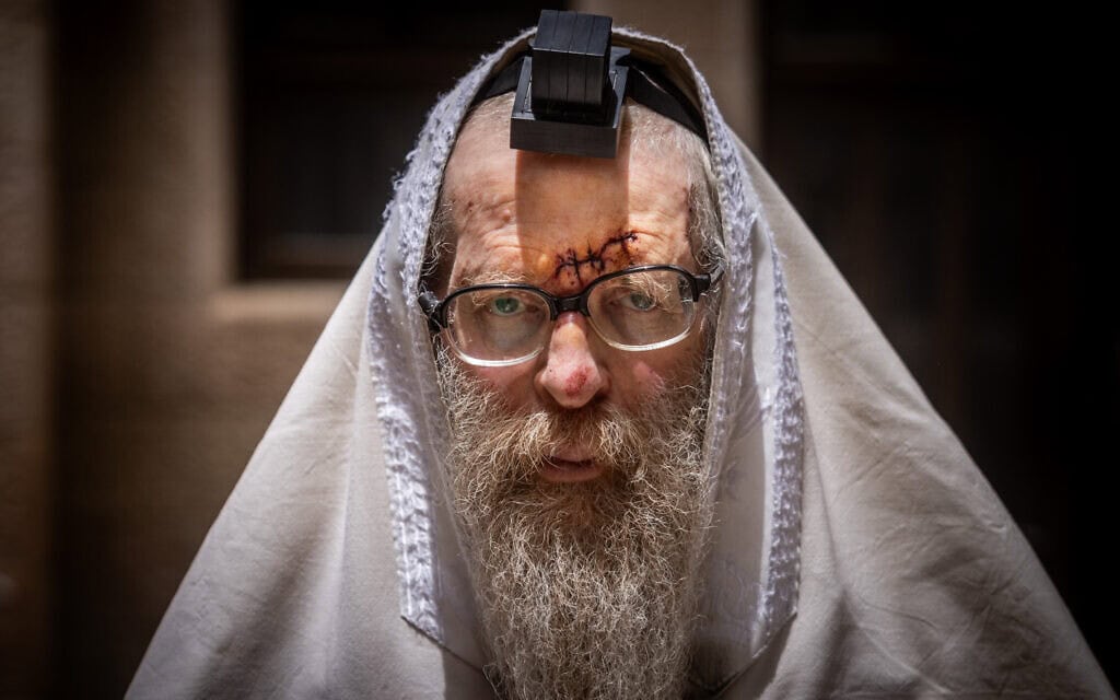 הרב אברהם קרויזר שנפצע לאחר ששוטר מג"ב דחף אותו במהלך חגיגות ל"ג בעומר במירון, 27 במאי 2024 (צילום: חיים גולדברג/פלאש90)