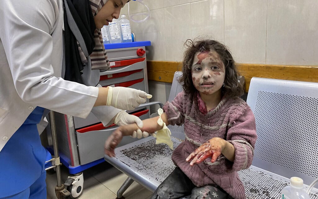 חובשת בבית החולים נאצר שבדרום רצועת עזה מטפל בילדה שנפצעה בחאן יונס, 3 ביוני 2025 (צילום: AFP)