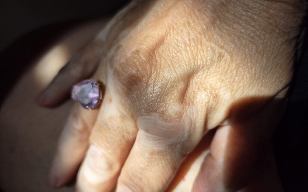 יד של אישה מבוגרת, אילוסטרציה (צילום: דפנה צרויה) יד של אישה מבוגרת, אילוסטרציה (צילום: דפנה צרויה)