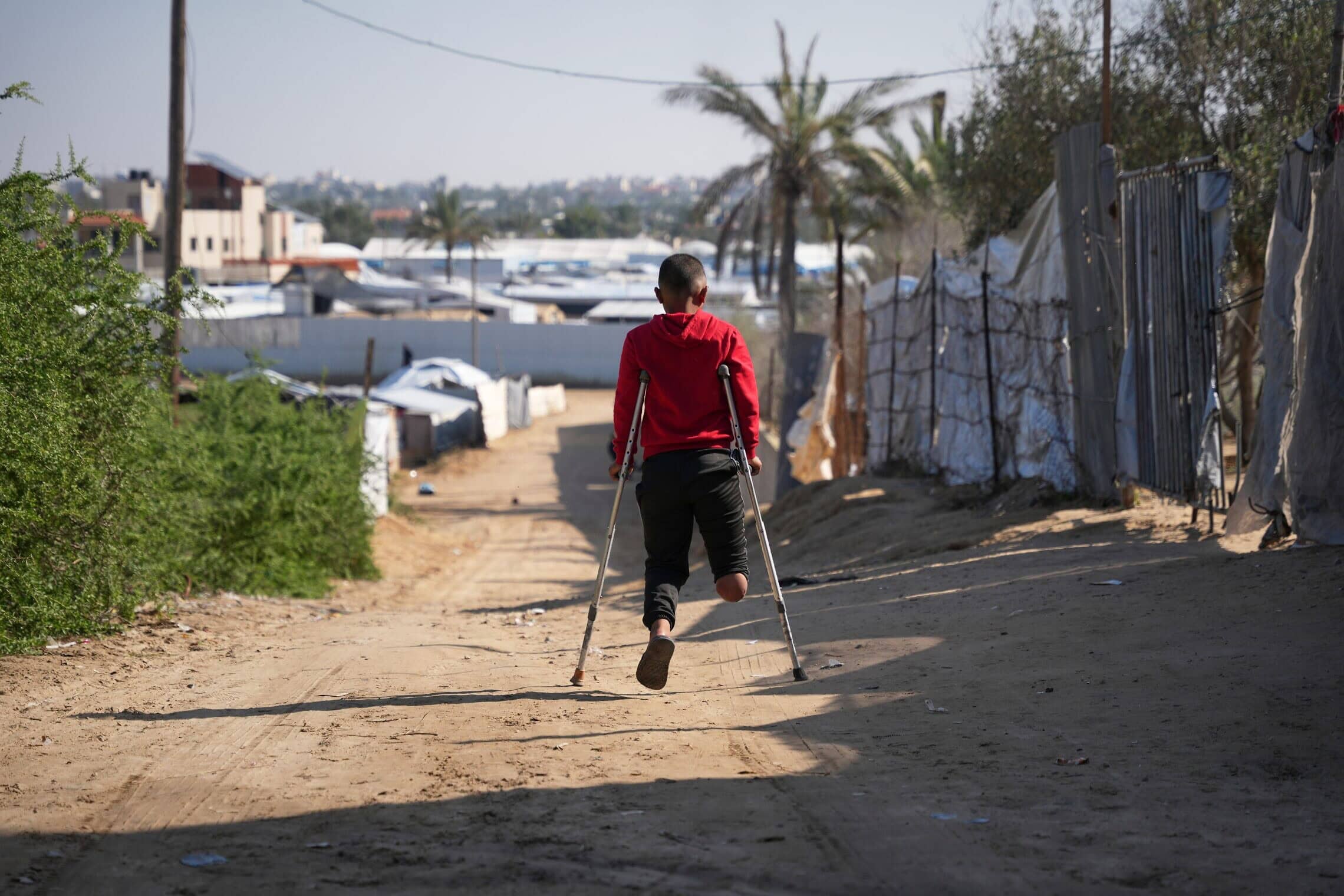 פאדי אל־בלביסי, בן 12, שרגלו הימנית נקטעה לאחר פגז שנורה בידי צבא ישראל ב־28 באפריל, צועד על קביים בדרכו הביתה לאחר שקיבל אימון שיקומי עם תותבת בבית החולים חאמד בזוואיידה, במרכז רצועת עזה, 4 בדצמבר 2025 (צילום: AP Photo/Abdel Kareem Hana) פאדי אל־בלביסי, בן 12, שרגלו הימנית נקטעה לאחר פגז שנורה בידי צבא ישראל ב־28 באפריל, צועד על קביים בדרכו הביתה לאחר שקיבל אימון שיקומי עם תותבת בבית החולים חאמד בזוואיידה, במרכז רצועת עזה, 4 בדצמבר 2025 (צילום: AP Photo/Abdel Kareem Hana)