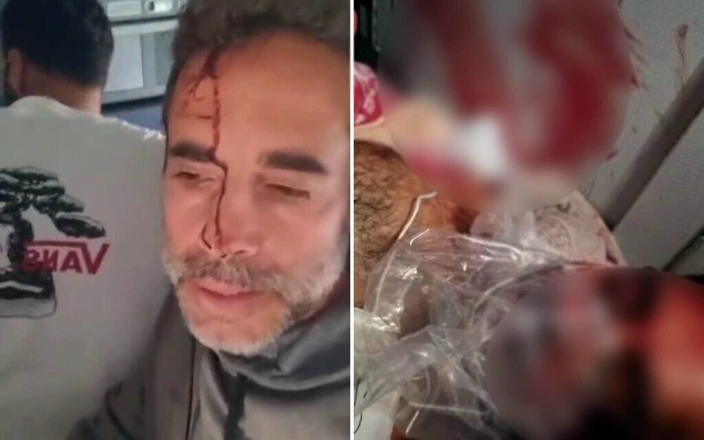 הישראלי שניטרל את טייס המשנה שניסה לרסק את מטוס פליי דובאי, 30 בספטמבר 2026 (צילום: מדיה חברתית: נעשה בה שימוש בהתאם לסעיף 27א' לחוק זכויות יוצרים) הישראלי שניטרל את טייס המשנה שניסה לרסק את מטוס פליי דובאי, 30 בספטמבר 2026 (צילום: מדיה חברתית: נעשה בה שימוש בהתאם לסעיף 27א' לחוק זכויות יוצרים)