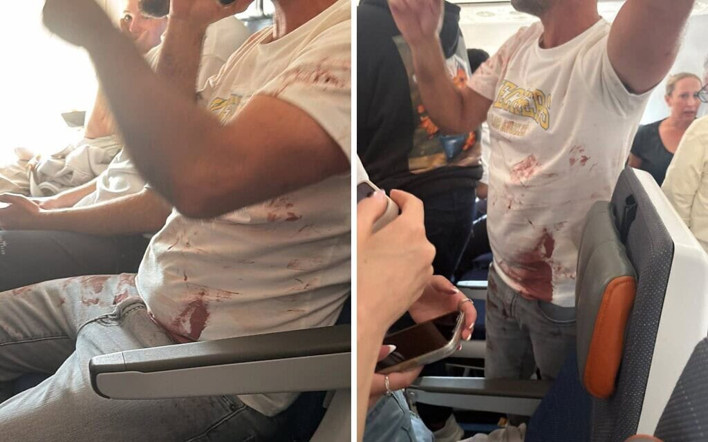 נוסע נראה עם חולצה מדממת על סיפון טיסה של פליי דובאי מדובאי לתל אביב, כאשר טייס המשנה דקר את הקפטן בניסיון לכאורה לרסק את המטוס המלא בישראלים, 30 בספטמבר 2026 (צילום: מדיה חברתית: בשימוש בהתאם לסעיף 27א לחוק זכויות יוצרים) נוסע נראה עם חולצה מדממת על סיפון טיסה של פליי דובאי מדובאי לתל אביב, כאשר טייס המשנה דקר את הקפטן בניסיון לכאורה לרסק את המטוס המלא בישראלים, 30 בספטמבר 2026 (צילום: מדיה חברתית: בשימוש בהתאם לסעיף 27א לחוק זכויות יוצרים)